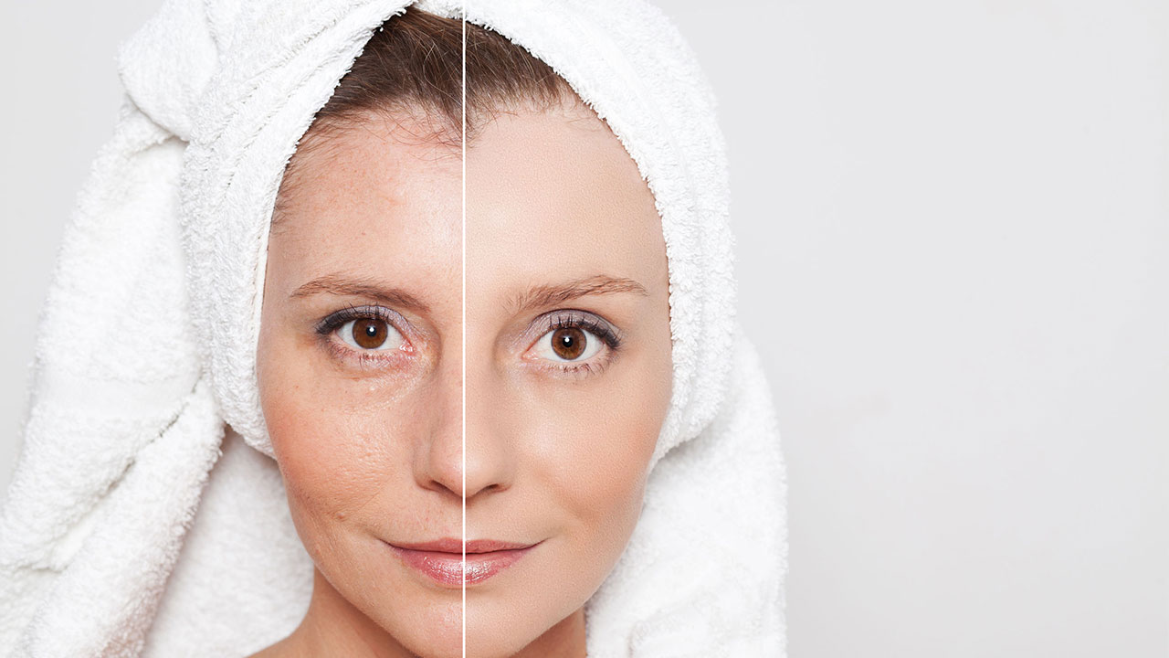 Gençlik Aşısı | Istanbul Botox Smileest