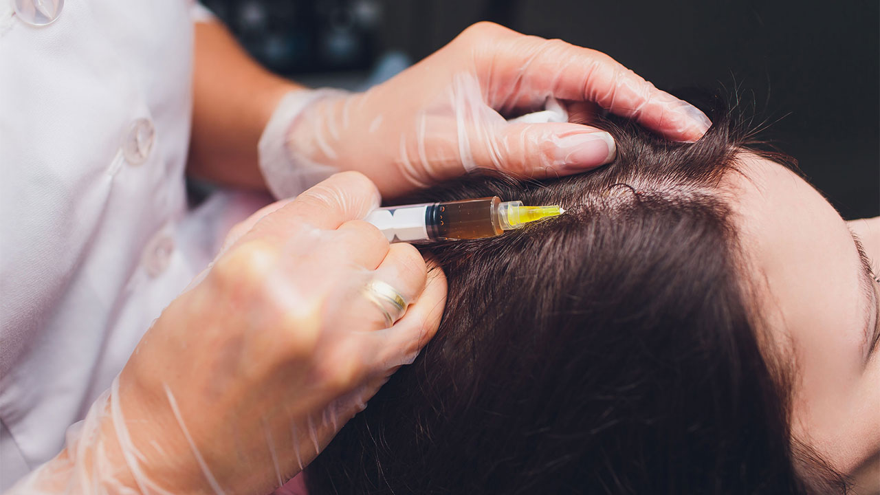 PRP İle Saç Tedavisi 