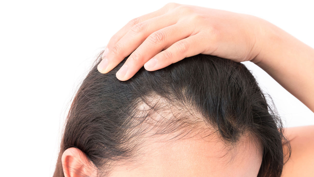 Saç Dökülmesinin Önlenmesi 